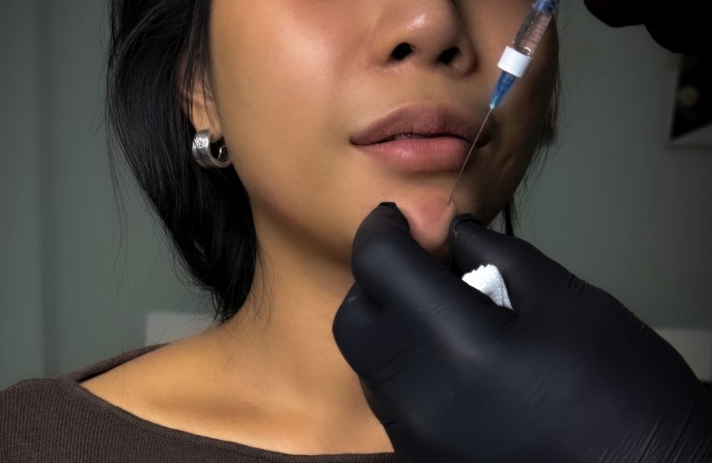 Client smiling after facial rejuvenation with certified doctor